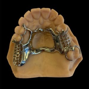 Prótesis Removibles